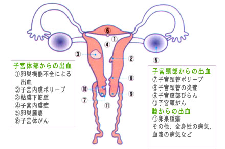 子宮 頚 管 ポリープ